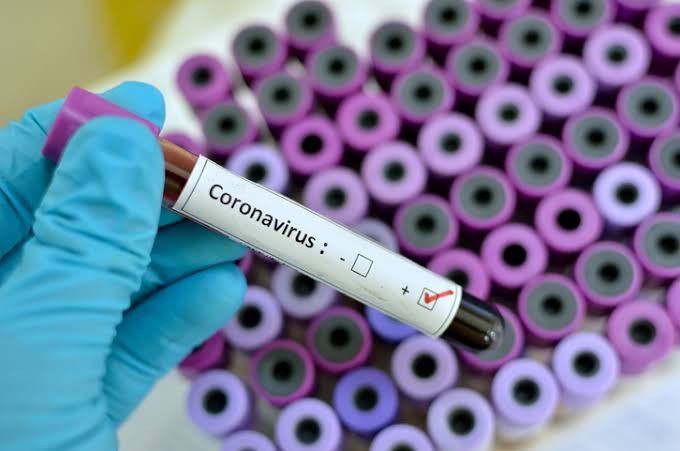 2 more Bangladeshis infected with coronavirus in Singapore